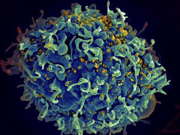 科研人员发现使艾滋病毒感染易于被清除的药物Vorinostat