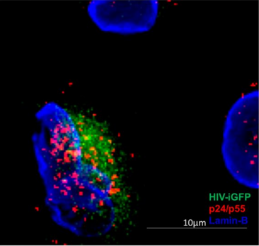 科学家开发新型艾滋病毒感染跟踪方法，HIV感染与早期的细胞质脱壳有关