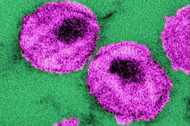 研究证实新研发的小分子化合物可有效踢杀艾滋病毒